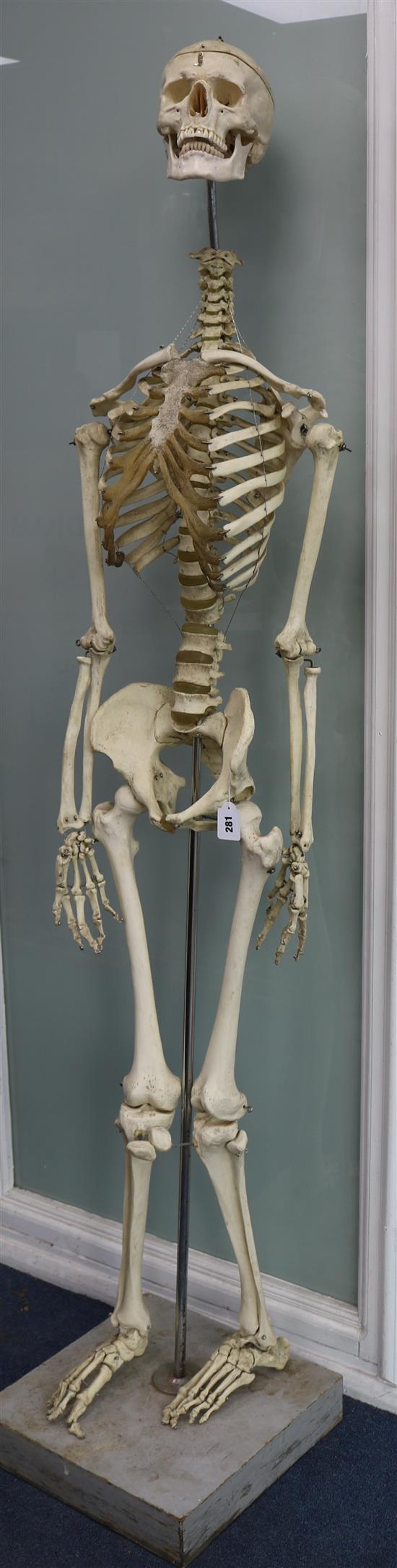 A skeleton on stand